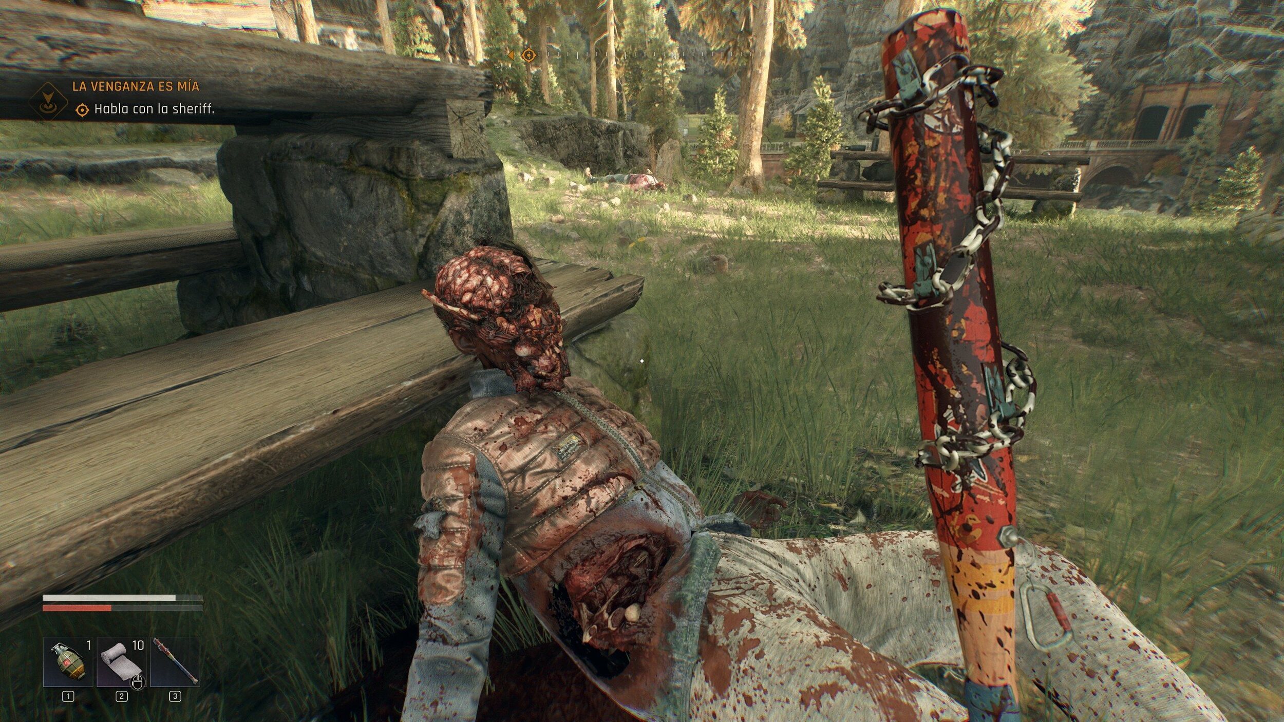 La violencia con la que se mutilan los cuerpos al golpearlos es extrema.